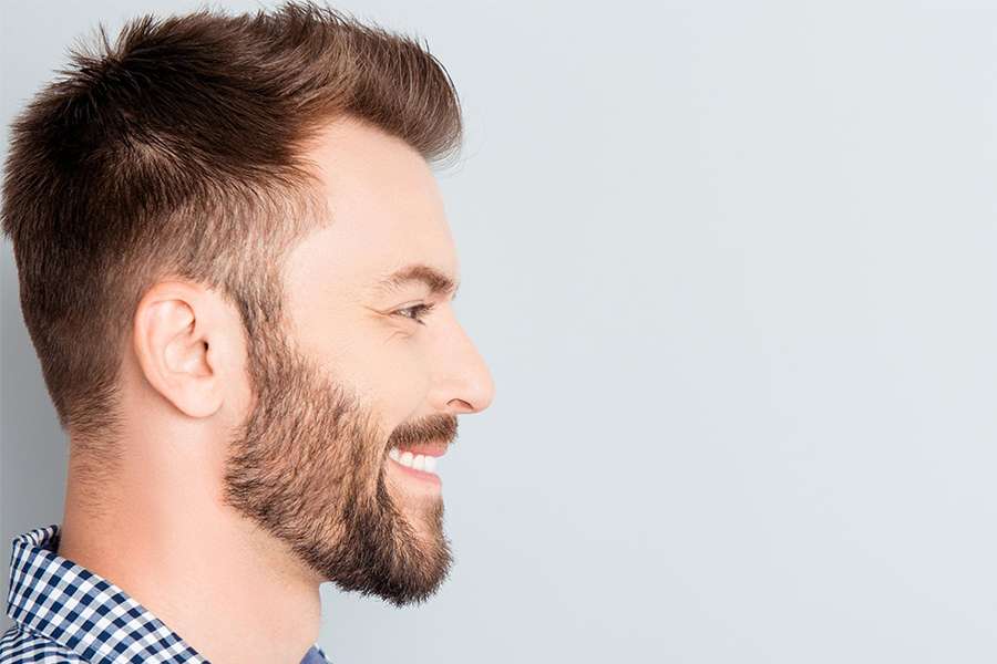 beard transplant